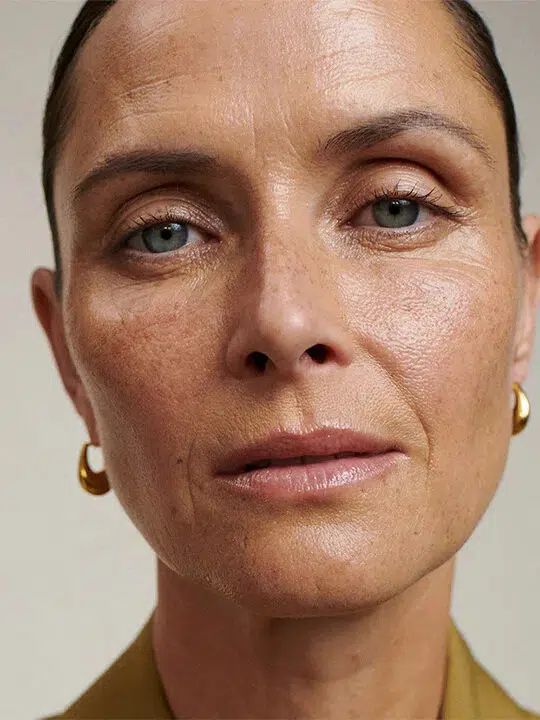 HIFU PACK OF 3 SESSIONS - Full Face