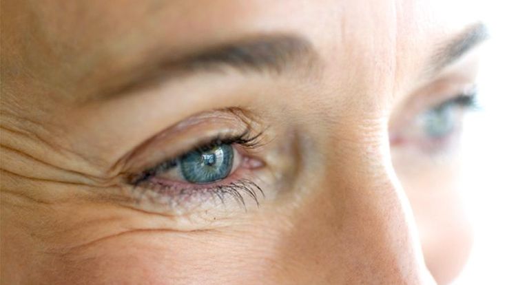 CO2 Laser Treatment