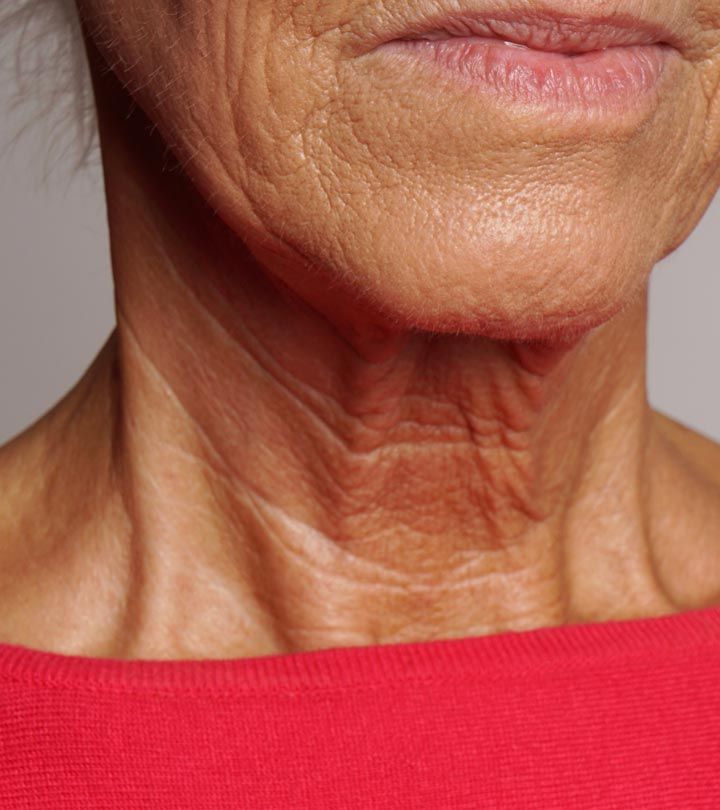 HIFU PACK OF 3 SESSIONS - Neck