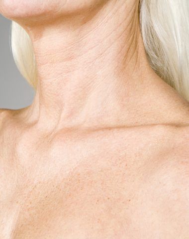 Laser Rejuvenation Process