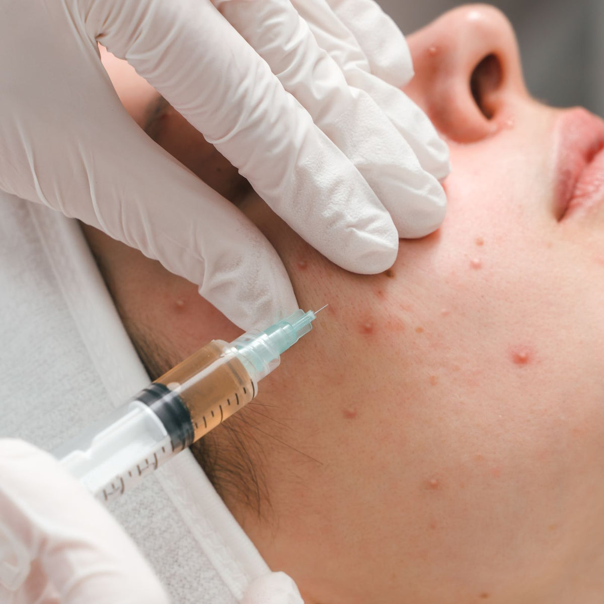 Treatment Process