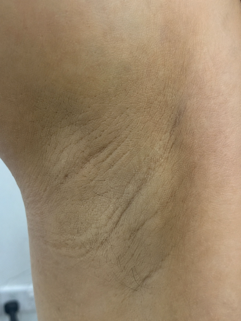 Before