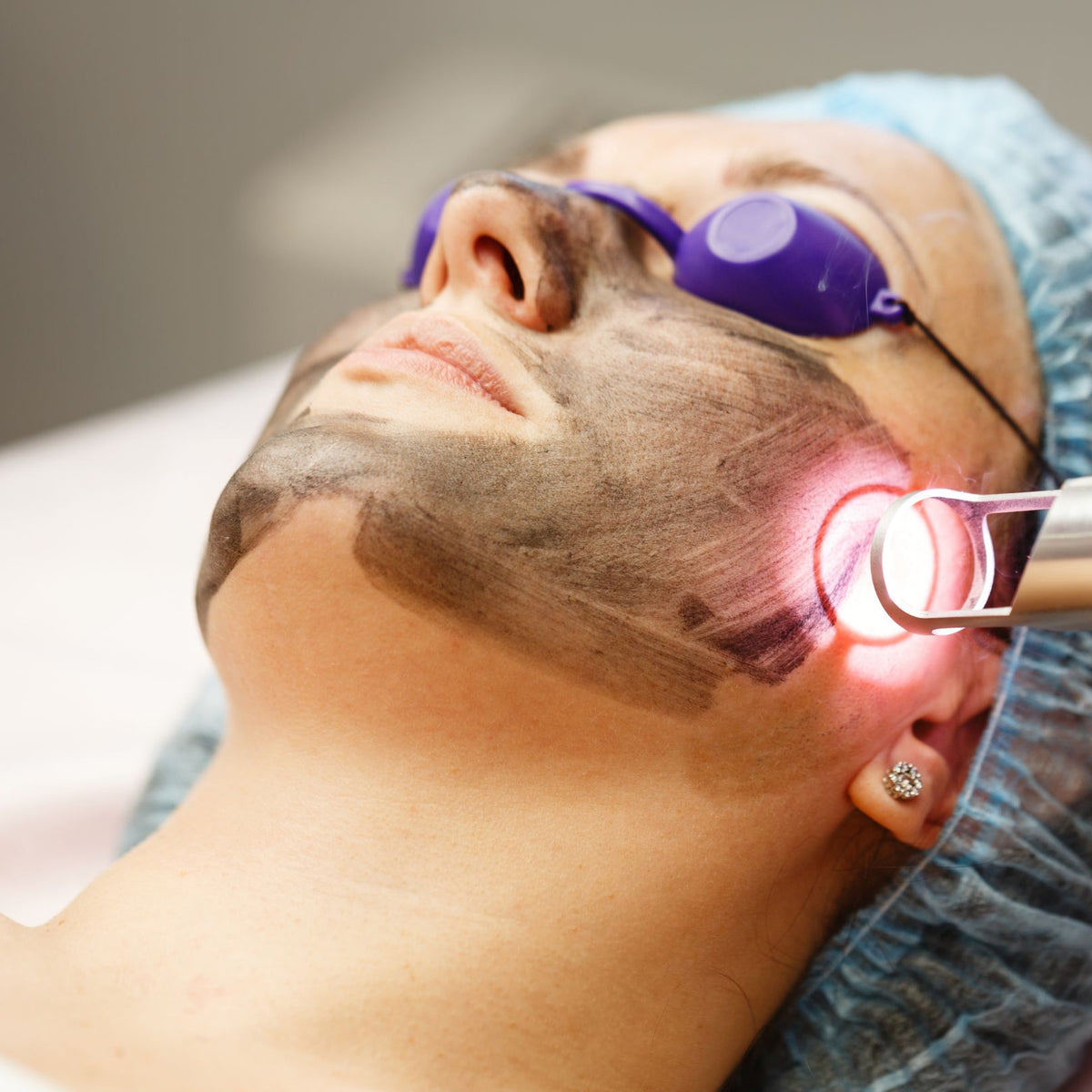 Laser Rejuvenation Process