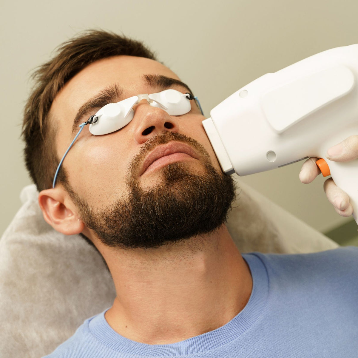 CO2 Laser Treatment