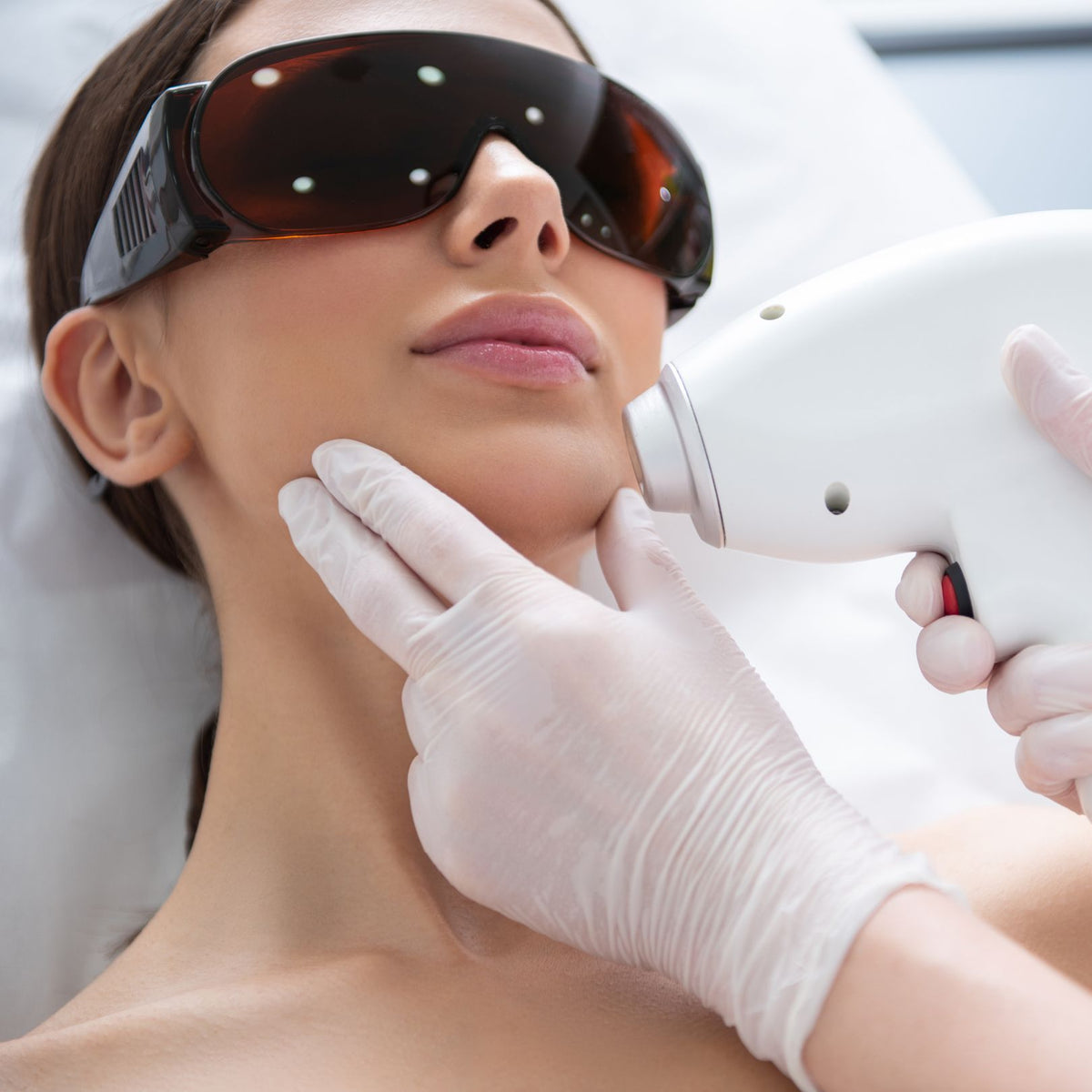 CO2 Laser Treatment
