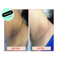 UNDERARM WHITENING SYDNEY