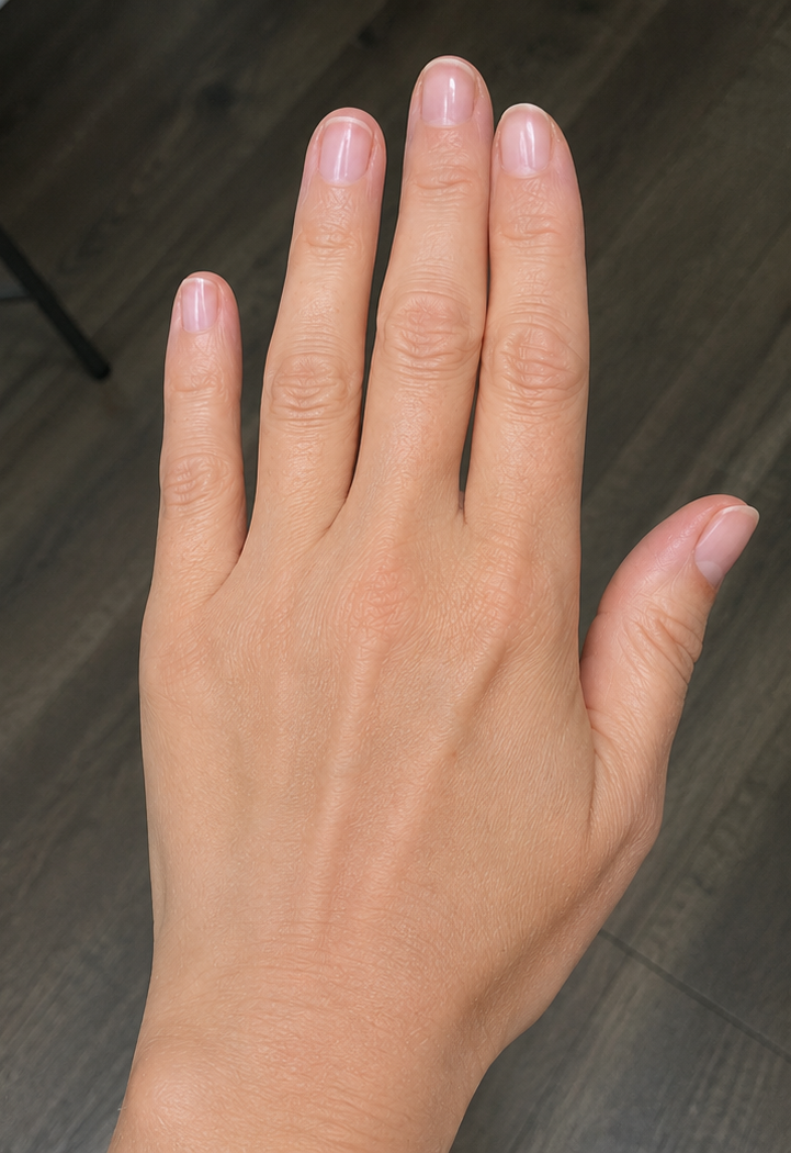 After